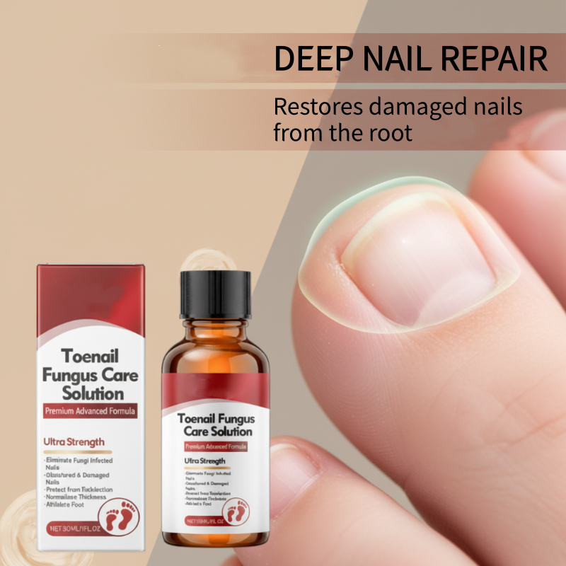 🔥Zeitlich begrenztes Weihnachtsangebot: 50 % RABATT!!!🔥 Nagel-Reparaturessenz für geschädigte Nägel